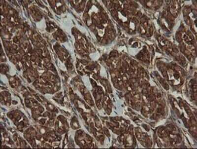 Immunohistochemistry: ROMO1 Antibody (OTI2C12) [NBP2-45607]