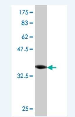 Western Blot: ROPN1 Antibody (1B10) [H00054763-M04]