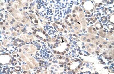 Immunohistochemistry-Paraffin: ROR alpha/NR1F1 Antibody [NBP1-52828]