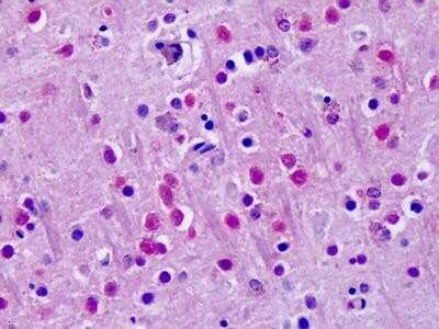 Immunohistochemistry-Paraffin: ROR alpha/NR1F1 Antibody - BSA Free [NLS2337]