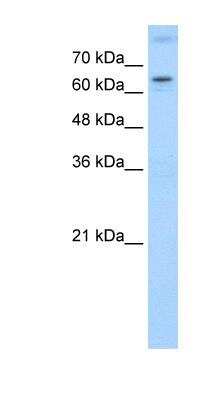 Western Blot: ROR alpha/NR1F1 Antibody [NBP1-52813]