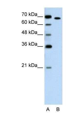 Western Blot: ROR alpha/NR1F1 Antibody [NBP1-52828]