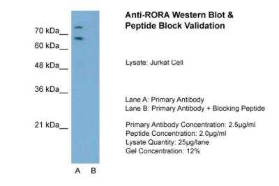 Western Blot: ROR alpha/NR1F1 Antibody [NBP1-52828]