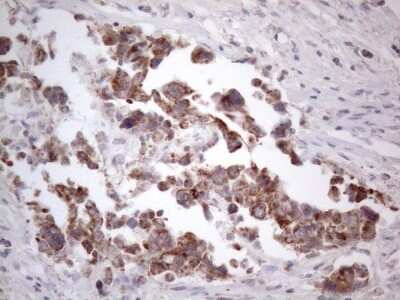 Immunohistochemistry: ROR beta Antibody (OTI1G1) [NBP2-45610]
