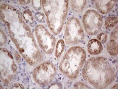 Immunohistochemistry: ROR beta Antibody (OTI1G1) [NBP2-45610]