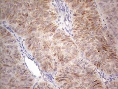 Immunohistochemistry: ROR beta Antibody (OTI1G1) [NBP2-45610]