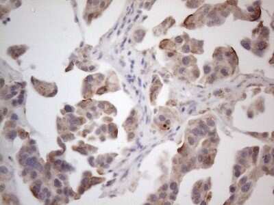 Immunohistochemistry: ROR beta Antibody (OTI1G1) [NBP2-45610]