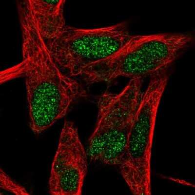 Immunocytochemistry/ Immunofluorescence: ROR beta Antibody [NBP1-82532]