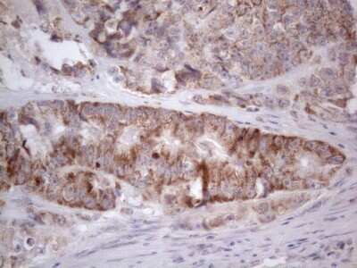 Immunohistochemistry: ROR beta Antibody (OTI1G1) - Azide and BSA Free [NBP2-73930]