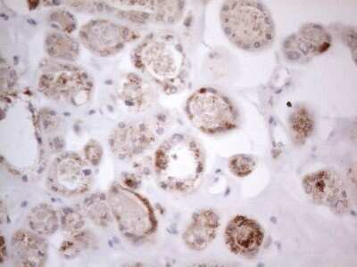 Immunohistochemistry: ROR beta Antibody (OTI1G1) - Azide and BSA Free [NBP2-73930]