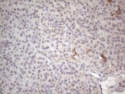 Immunohistochemistry: ROR beta Antibody (OTI1G1) - Azide and BSA Free [NBP2-73930]