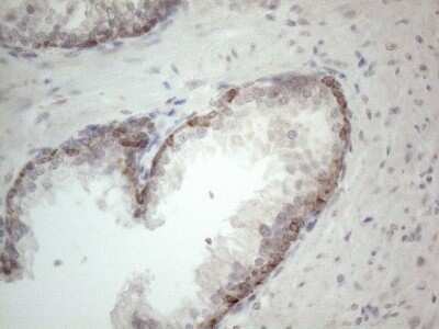 Immunohistochemistry: ROR beta Antibody (OTI1G1) - Azide and BSA Free [NBP2-73930]