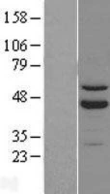 Western Blot: ROR beta Overexpression Lysate [NBL1-15481]