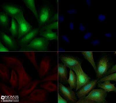 Immunocytochemistry/ Immunofluorescence: ROR gamma/RORC/NR1F3 Antibody - BSA Free [NBP2-24503]