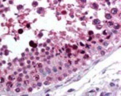 Immunohistochemistry-Paraffin: ROR gamma/RORC/NR1F3 Antibody - BSA Free [NBP2-24503]