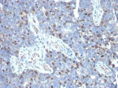 Immunohistochemistry-Paraffin: ROR gamma/RORC/NR1F3 Antibody (RORC/2941) - Azide and BSA Free [NBP3-08314]