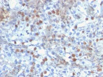Immunohistochemistry-Paraffin: ROR gamma/RORC/NR1F3 Antibody (RORC/2941) - Azide and BSA Free [NBP3-08314]