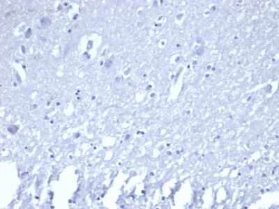 Immunohistochemistry-Paraffin: ROR gamma/RORC/NR1F3 Antibody (RORC/2941) - Azide and BSA Free [NBP3-08314]