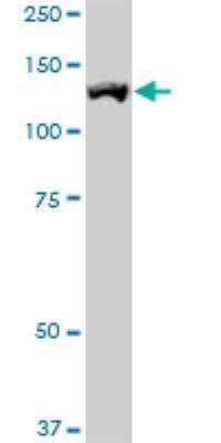 Western Blot: ROR1 Antibody (2F8) [H00004919-M01]