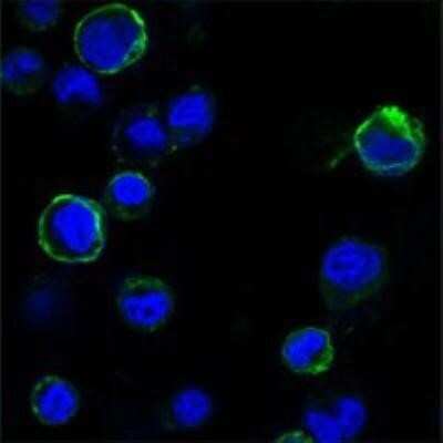 Immunocytochemistry/ Immunofluorescence: ROR1 Antibody (2H6) - BSA Free [NBP1-47449]