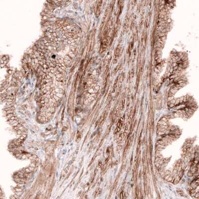 Immunohistochemistry-Paraffin: ROR2 Antibody (CL5950) [NBP2-61434]