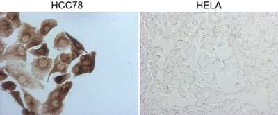 Immunohistochemistry: ROS Antibody (OTI1A1) - Azide and BSA Free [NBP2-73933]