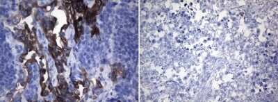 Immunohistochemistry: ROS Antibody (OTI1A1) - Azide and BSA Free [NBP2-73933]