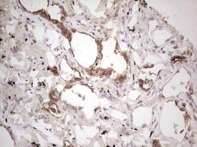 Immunohistochemistry: ROS Antibody (OTI1F3) - Azide and BSA Free [NBP2-73932]