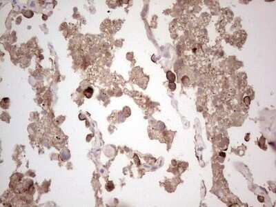 Immunohistochemistry: ROS Antibody (OTI1F3) - Azide and BSA Free [NBP2-73932]