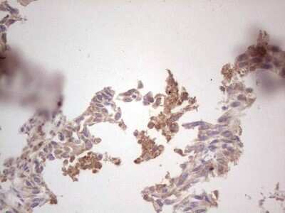 Immunohistochemistry: ROS Antibody (OTI1F3) - Azide and BSA Free [NBP2-73932]