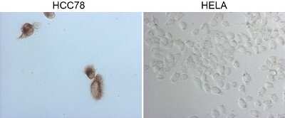 Immunohistochemistry-Paraffin: ROS Antibody (OTI1F3) [NBP2-45626]