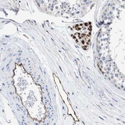 Immunohistochemistry-Paraffin: RP1-127L4.6 Antibody [NBP1-91083]