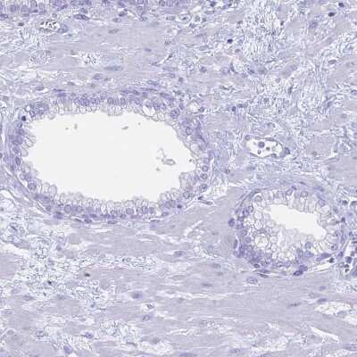 Immunohistochemistry-Paraffin: RP1 Antibody [NBP1-90597]