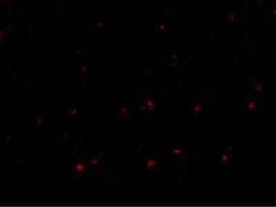 Immunocytochemistry/ Immunofluorescence: RP105/CD180 Antibody - BSA Free [NBP1-76706]