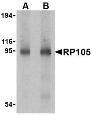 Western Blot: RP105/CD180 AntibodyBSA Free [NBP1-76705]