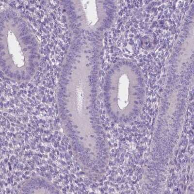 Immunohistochemistry-Paraffin: RP11-195F19.5 Antibody [NBP2-49609]