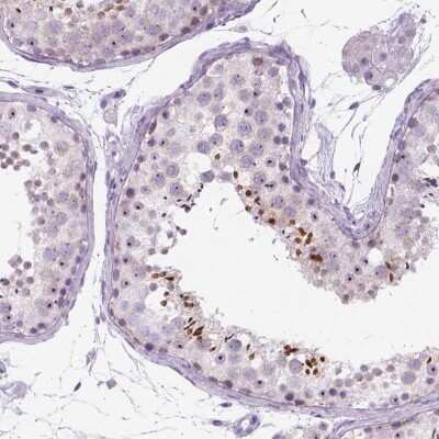 Immunohistochemistry-Paraffin: RP11-195F19.5 Antibody [NBP2-49609]