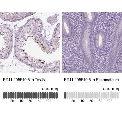 Immunohistochemistry-Paraffin: RP11-195F19.5 Antibody [NBP2-49609]