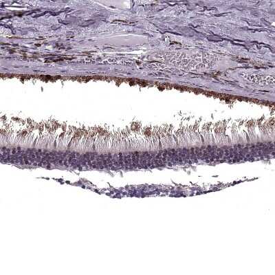 Immunohistochemistry-Paraffin: RP1L1 Antibody [NBP2-55240]