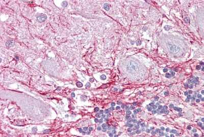 Immunohistochemistry-Paraffin: RP2 Antibody [NBP1-56852]