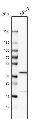 Western Blot: RP2 Antibody [NBP1-82549]