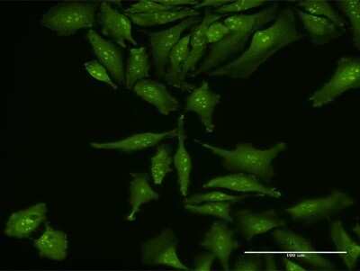 Immunocytochemistry/ Immunofluorescence: RP5-1077B9.4 Antibody [H00060672-B01P]