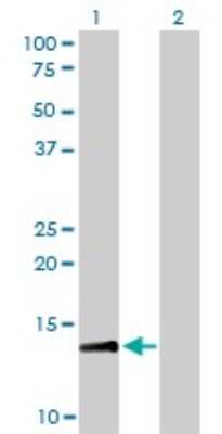 Western Blot: RPA14 Antibody (1F4) [H00006119-M01]