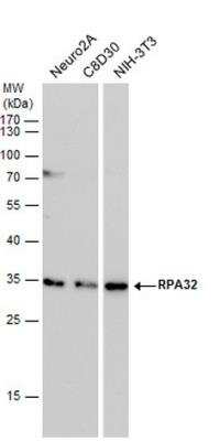 Western Blot: RPA2 Antibody (12F3.3) [NB100-158]