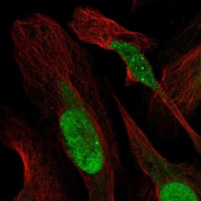Immunocytochemistry/ Immunofluorescence: RPA2 Antibody [NBP1-89523]