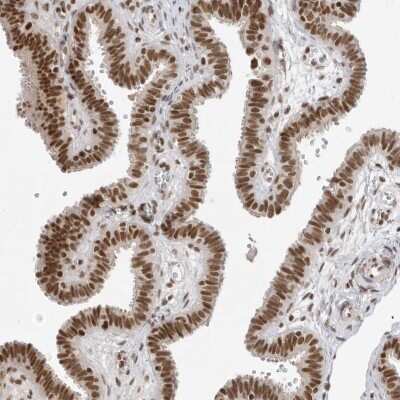 Immunohistochemistry-Paraffin: RPA2 Antibody [NBP1-89523]