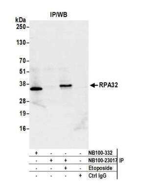 Immunoprecipitation: RPA2 Antibody [NB100-332]