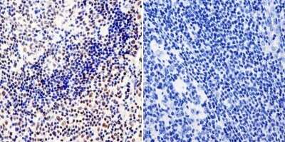 Immunohistochemistry-Paraffin: RPA2 Antibody (MA34) [NB100-74526]