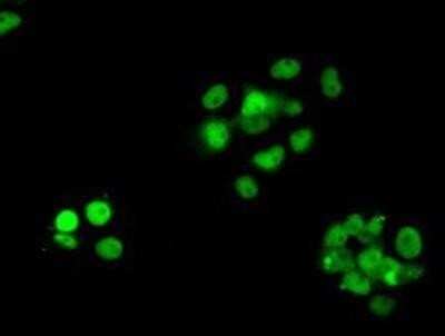 Immunocytochemistry/ Immunofluorescence: RPA2 Antibody (OTI9A1) - Azide and BSA Free [NBP2-73935]