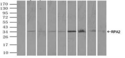 Immunoprecipitation: RPA2 Antibody (OTI9A1) - Azide and BSA Free [NBP2-73935]